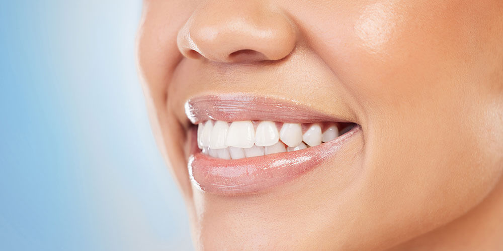 Fluoride Treatment Hamilton