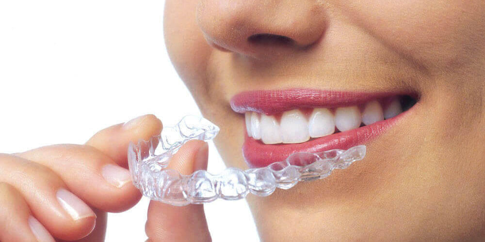 Invisalign Hamilton