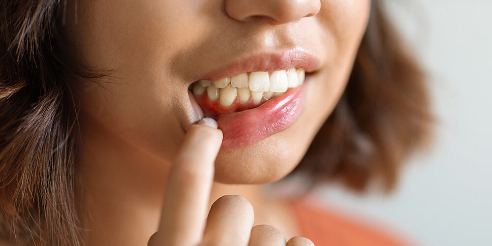 Periodontal Therapy Hamilton